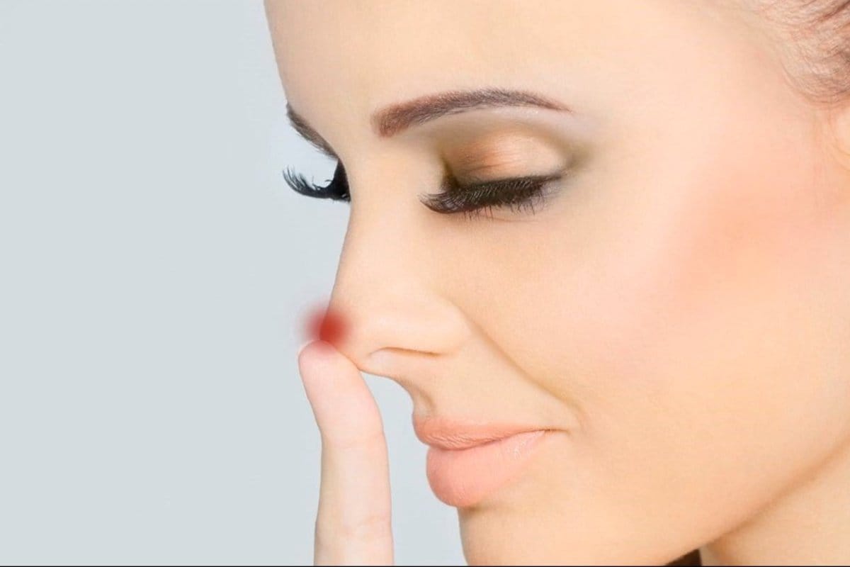 Ikääntyminen: Kasvavatko nenä ja korvat iän myötä?