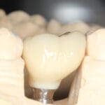 Tutkijat paljastivat 1500 vuotta vanhan salaisuuden historian ensimmäisestä pandemiasta hampaiden avulla