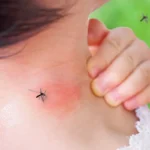 Vältä hyttysenpistot ilman pitkiä vaatteita tai kaupallisia karkotteita: Kotitekoinen citronella-ranneke