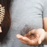 Paras ruoka hiustenlähtöön: mitä lääkärit suosittelevat vahvempien hiusten saamiseksi