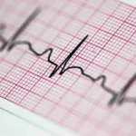 Kardioologit nimesivät tuotteet, joita ei suositella syötäväksi aamiaisella yli 60-vuotiaana