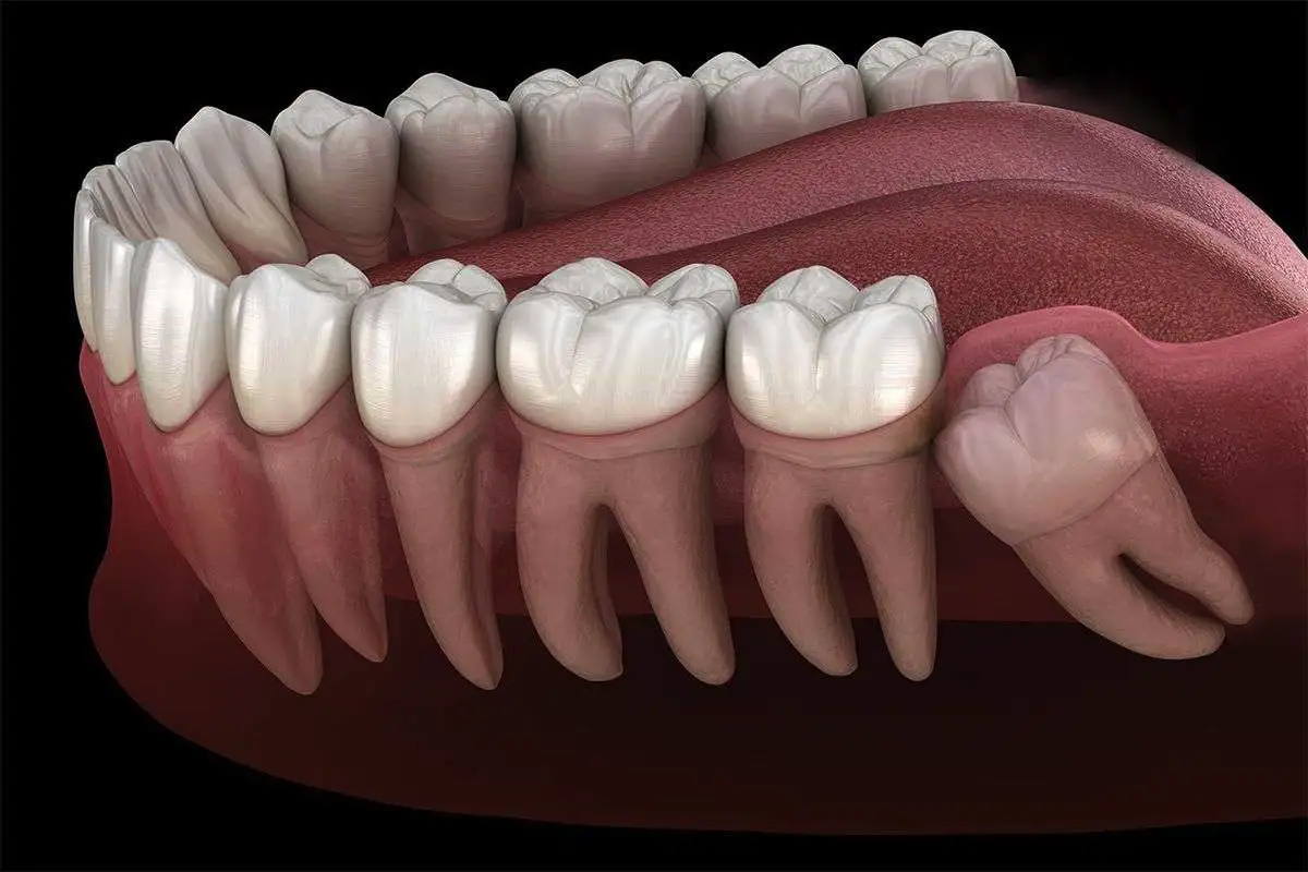 6 täysin turhaa elimiä: miksi kehomme pitää kiinni näistä?