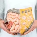 Viisi vihannesta, jotka auttavat polttamaan viskeraalista rasvaa