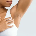 Miksi kainalot tummuvat ja miten niitä voi vaalentaa?