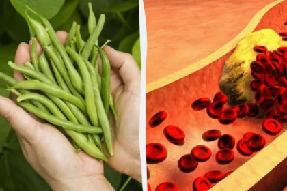 Mustapavut – Paras Hiilihydraatti Kolesterolin Laskemiseen: Ravitsemusterapeutin Suositus – Lisää Ruokavalioon Tänään Ja Tunne Ero