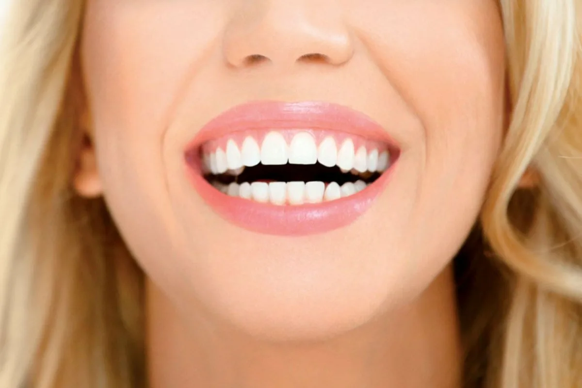 Heippa keltaisille hampaille: ruoka, joka sisältää rautaa ja kollageenia – poistaa plakin ja valkaisee hampaat luonnollisesti