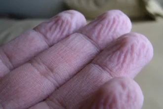 Miksi sormet rypistyvät vedessä? Suomalainen liffihakki paljastaa: kyse ei ole imeytymisestä
