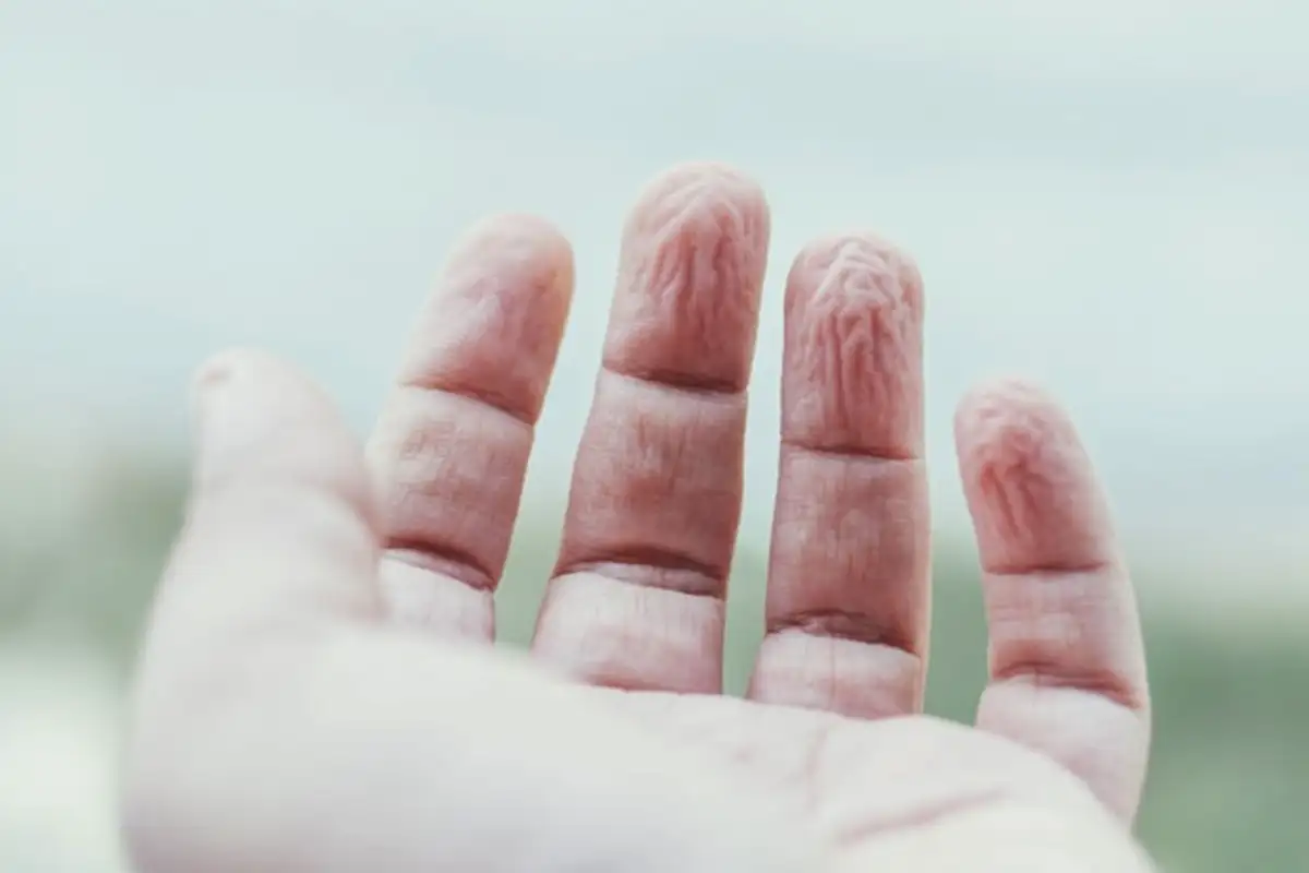 Miksi sormet rypistyvät vedessä? Suomalainen liffihakki paljastaa: kyse ei ole imeytymisestä