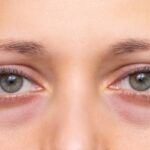 Näin muokkaat ruokavaliota turvotuksen vähentämiseksi – ravitsemusterapeutin vinkit